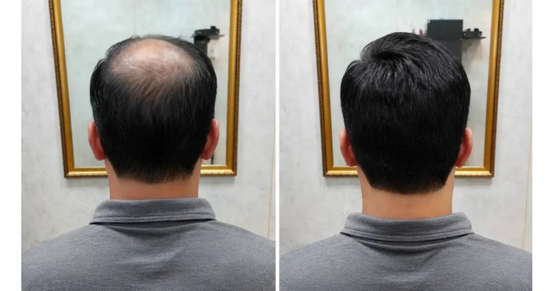 Hairslook