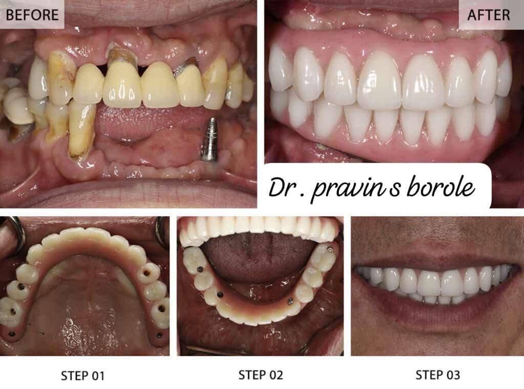 Anand Dental clinic & implant center