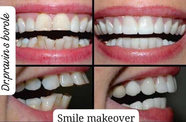 Anand Dental clinic & implant center
